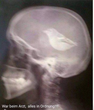 Vogel im Kopf